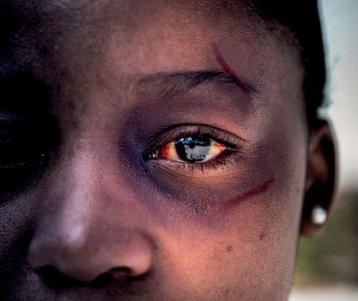 Stop GBV Abuse